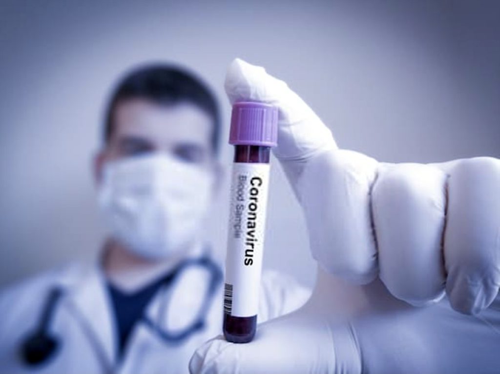 Did a Novel in 1981 Predict a Coronavirus Outbreak? Mystery of Wuhan 400 Virus