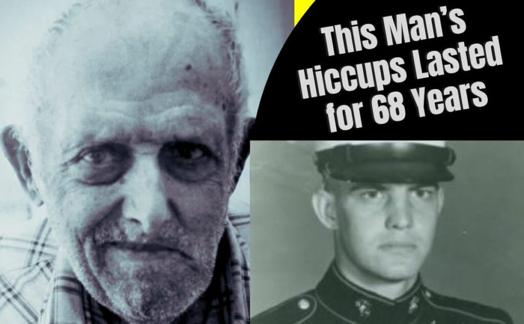 The Man Who Hiccupped for 68 Years, The Remarkable Story of Charles Osborne