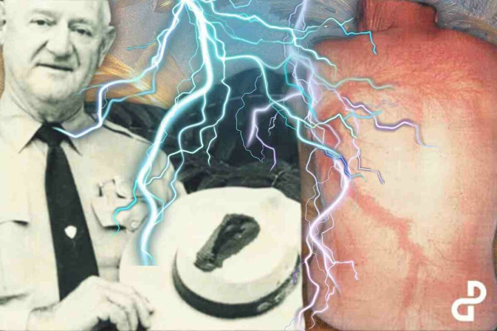 Roy Sullivan: The Man Struck by Lightning Seven Times and Lived to Tell the Tale