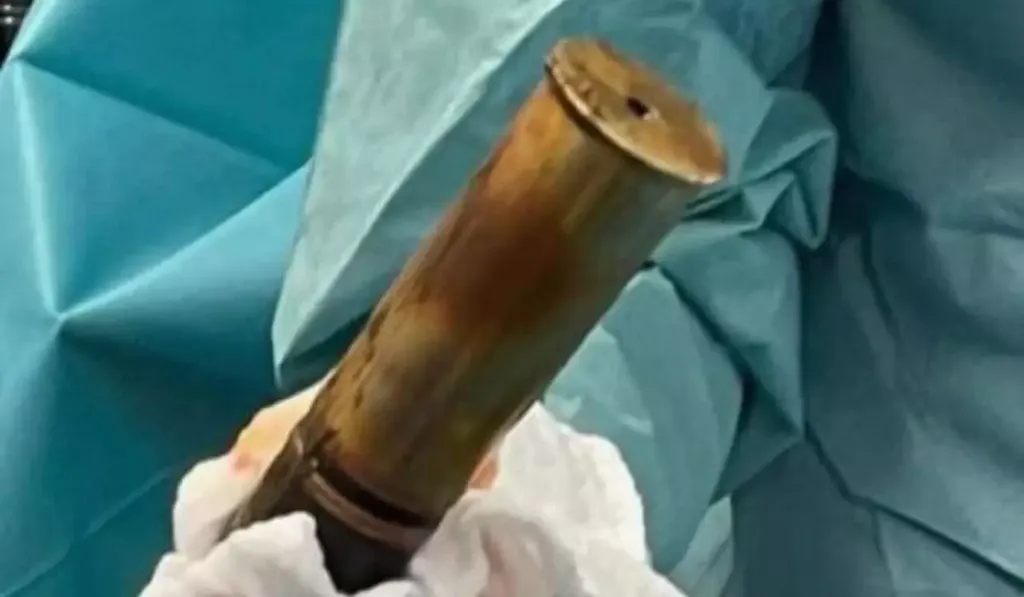 Man With Artillery Shell Stuck in Rectum Causes Bomb Scare at Hospital