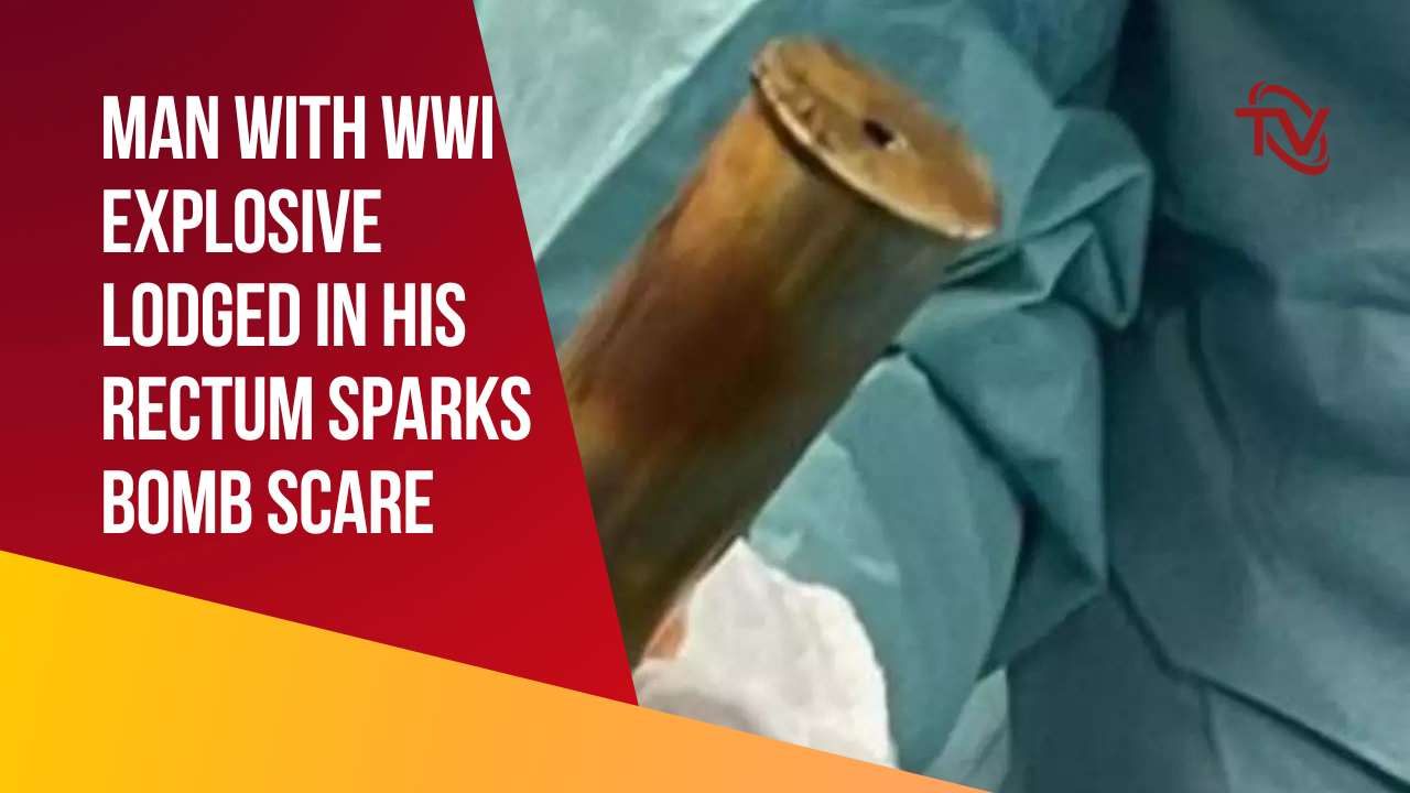 An 88-year-old man arrived at Hospital Sainte Musse in Toulon with a World War I artillery shell lodged in his rectum, causing a "bomb scare" and leading to the partial evacuation of the hospital