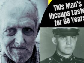 This Man’s Hiccups Lasted for 68 Years