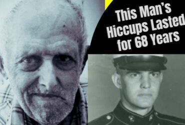This Man’s Hiccups Lasted for 68 Years